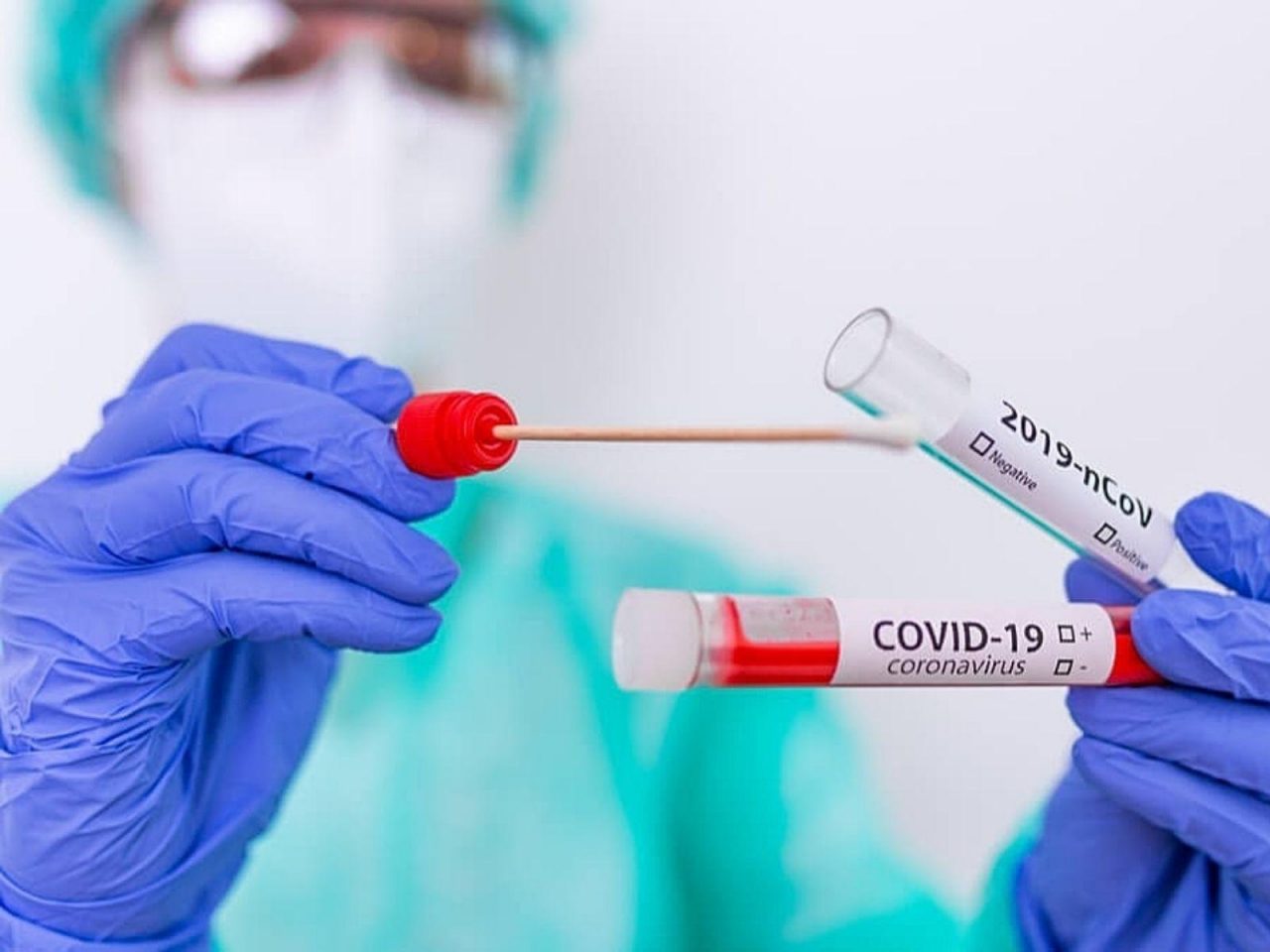 Принят перечень случаев для проведения бесплатных ПЦР-тестов на коронавирус 